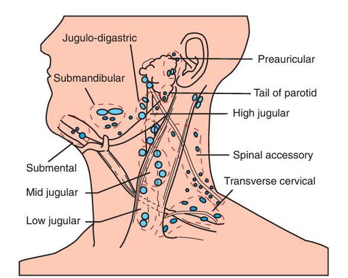 Squamous Cell Carcinoma, Metastatic Spread