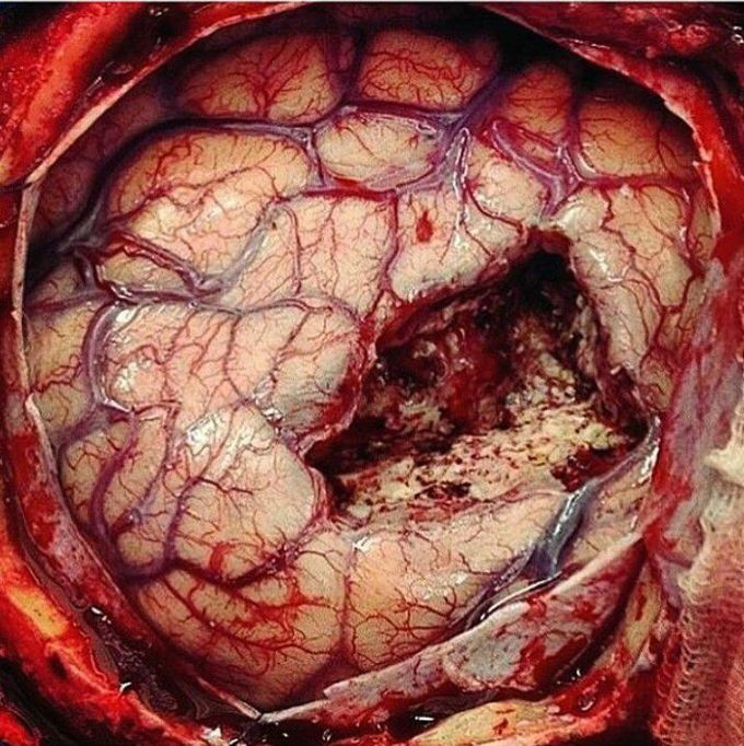 Parts of body