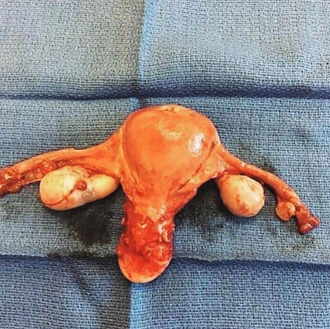 What do you think this is ?
