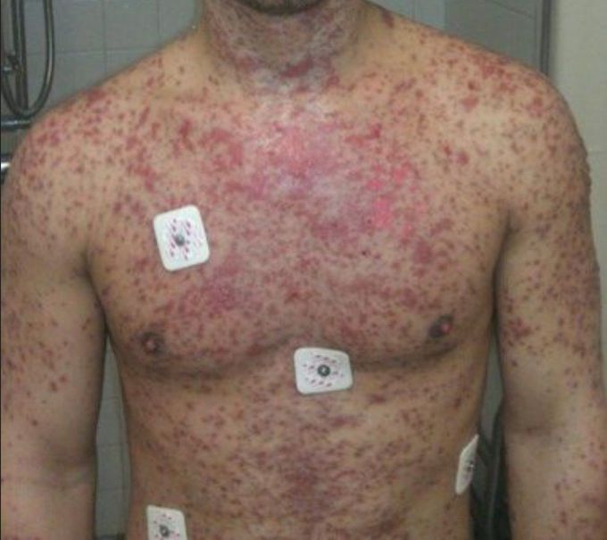 What's your dx??