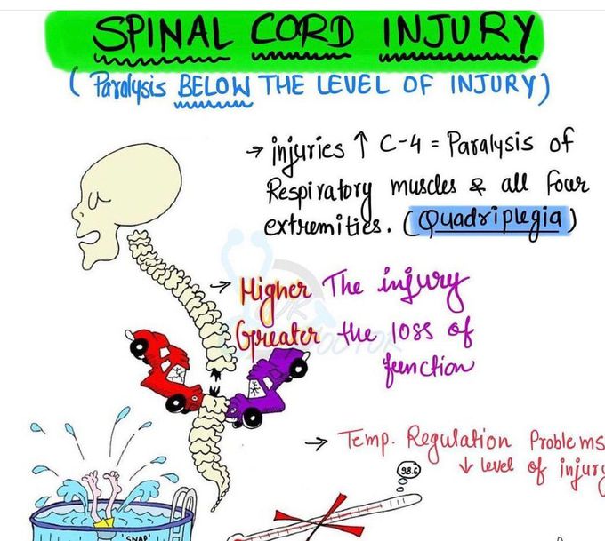 Spinal Cord Injury