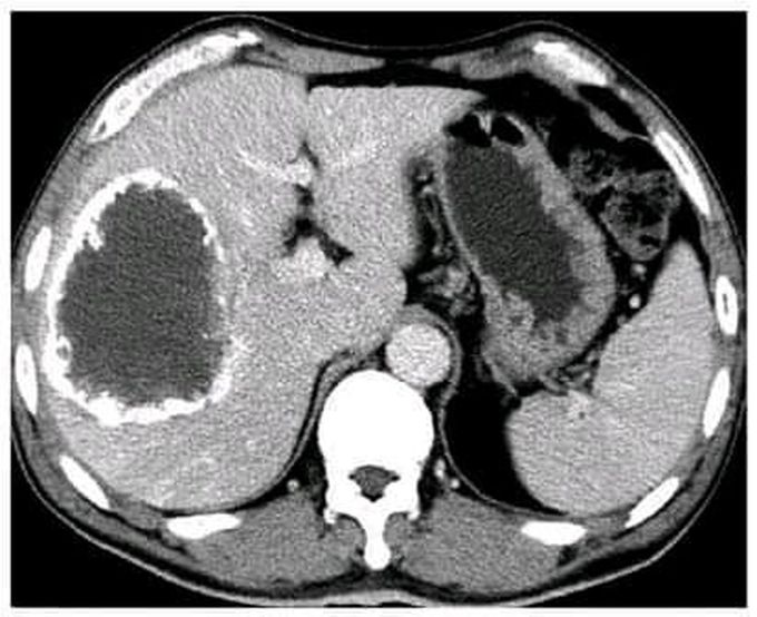 What is your diagnosis?