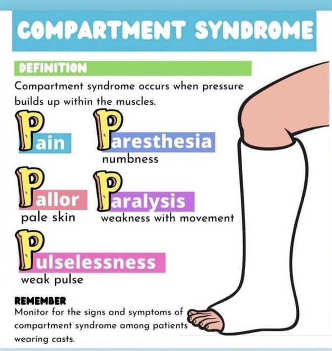 Compartment Syndrome