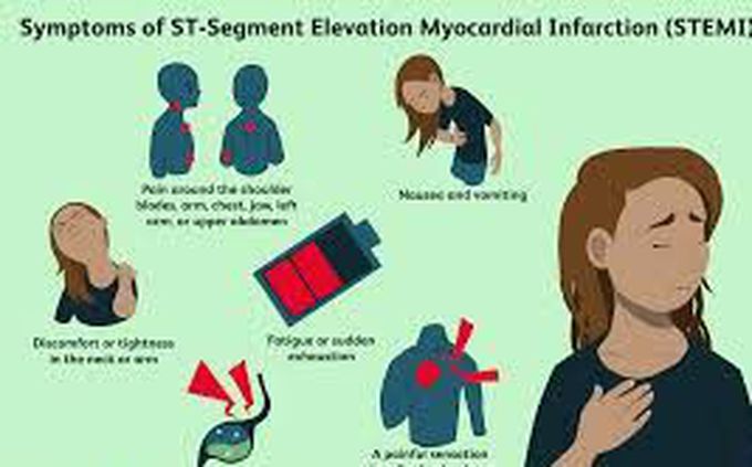 Symptoms of myocardial infarction