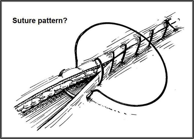 What Kind Of Suture Pattern Is Depicted