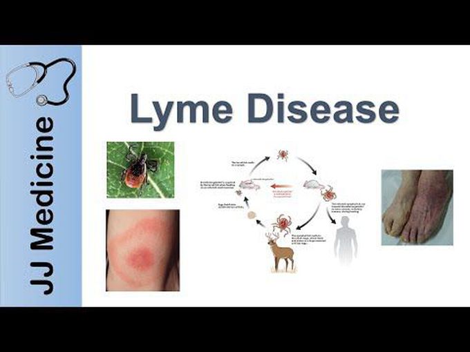 Lyme Disease