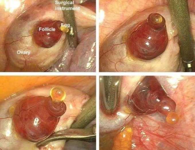 OVULATION