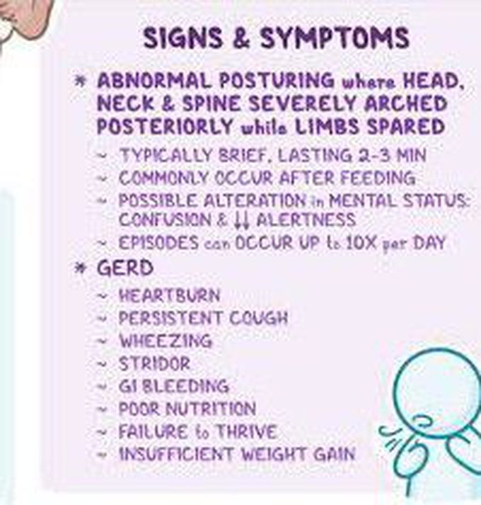 These are the signs and symptoms of Sandifer syndrome