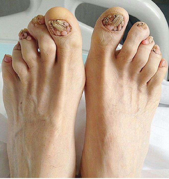 Diagnosis??