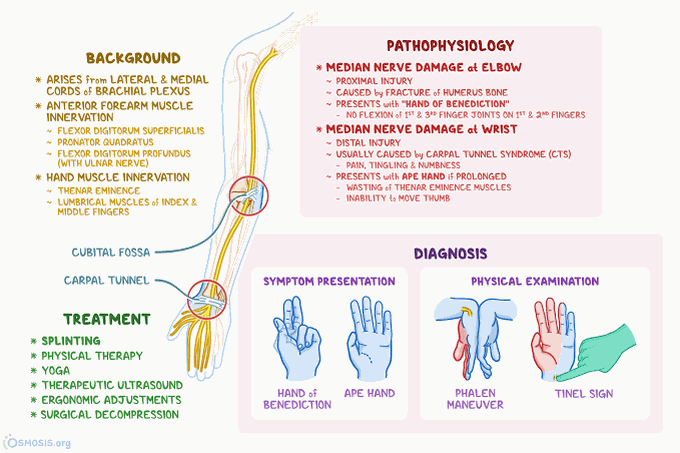 Symptoms of median nerve problems