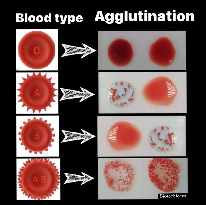 Blood Type  and Agglutination