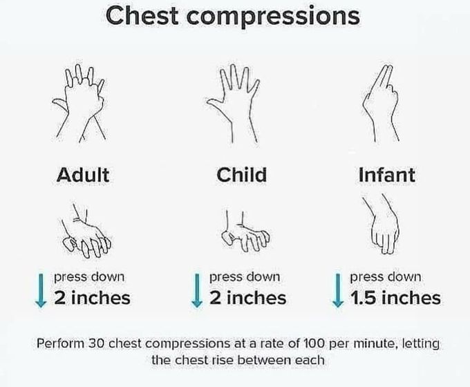 Chest compressions