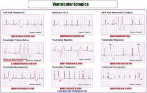 ECG - MEDizzy