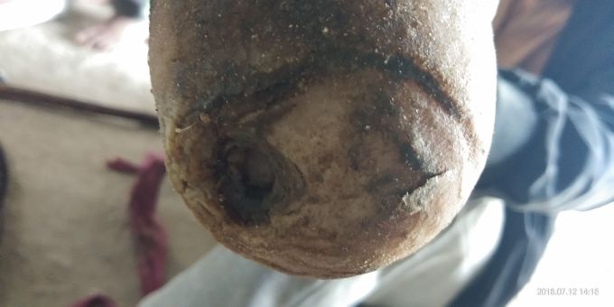 What is diagnosis