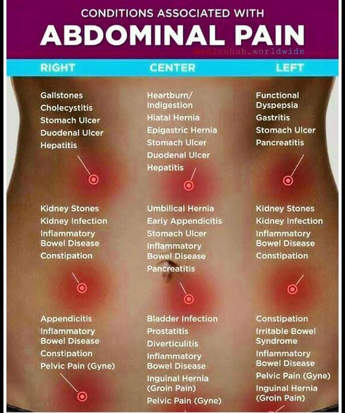 Conditions associated with abdominal pain