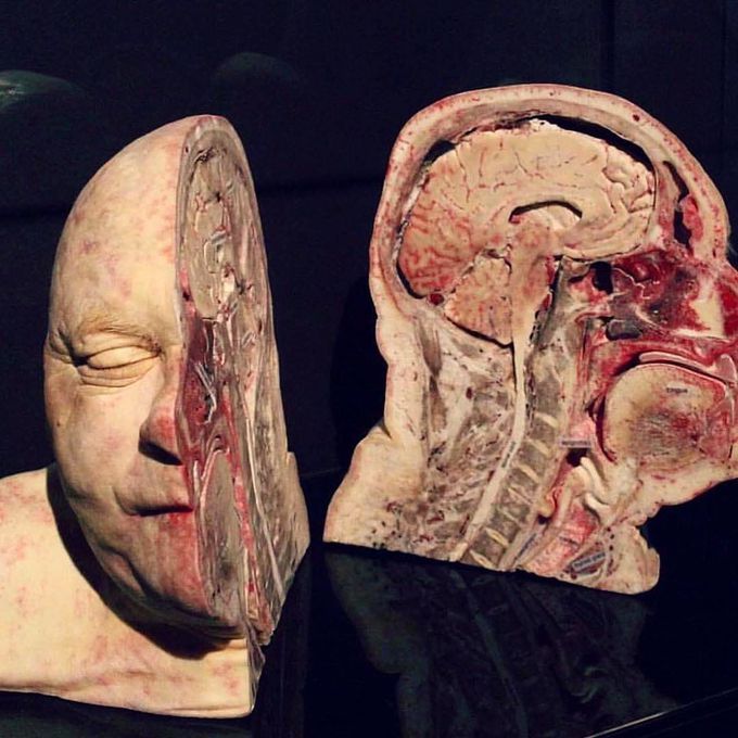 Mid-sagittal plane cross section