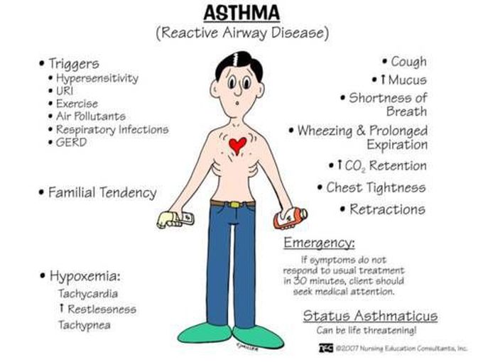 Asthma