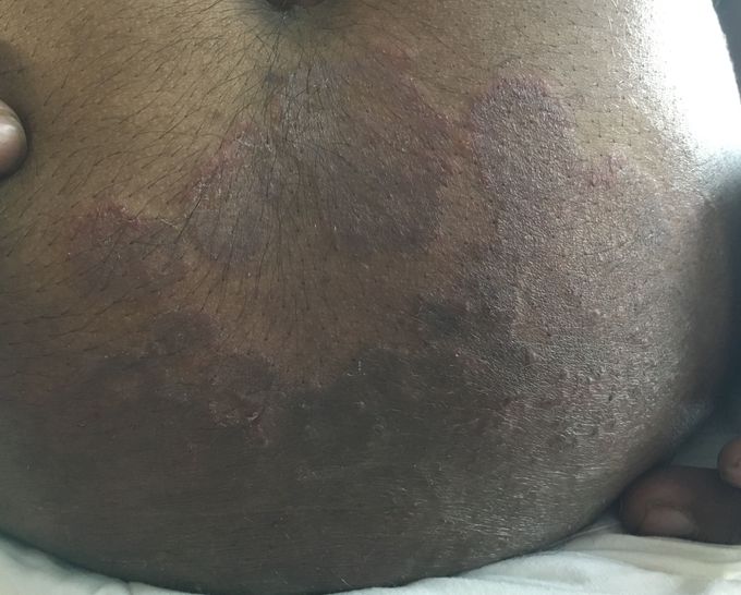 Diagnosis please