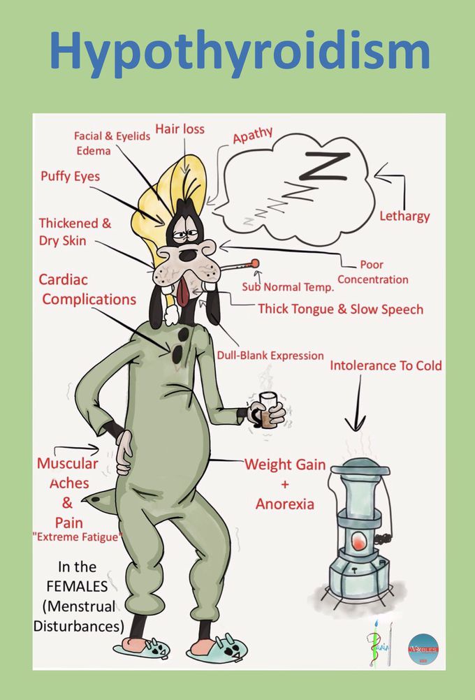 HypOthyroidism