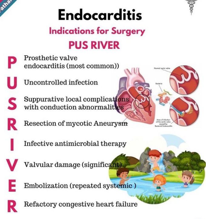 Indication for surgery of endocarditis