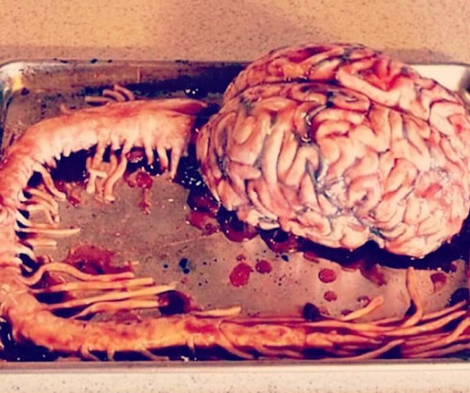 The nervous system