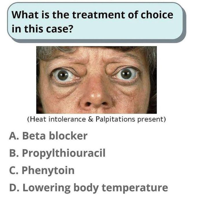 What is the treatment of choice?
