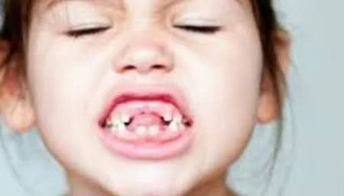 First Ever Tooth Regenerating Drug!