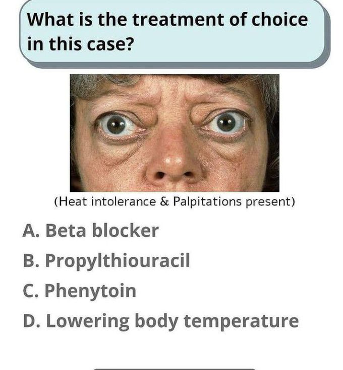 What is the Treatment of choice?