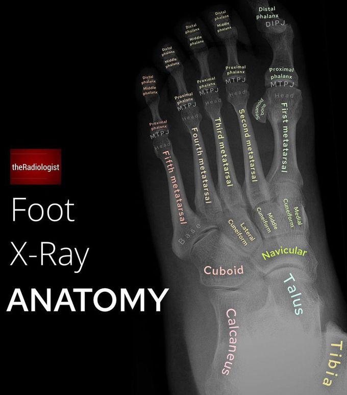 Foot X-ray Anatomy