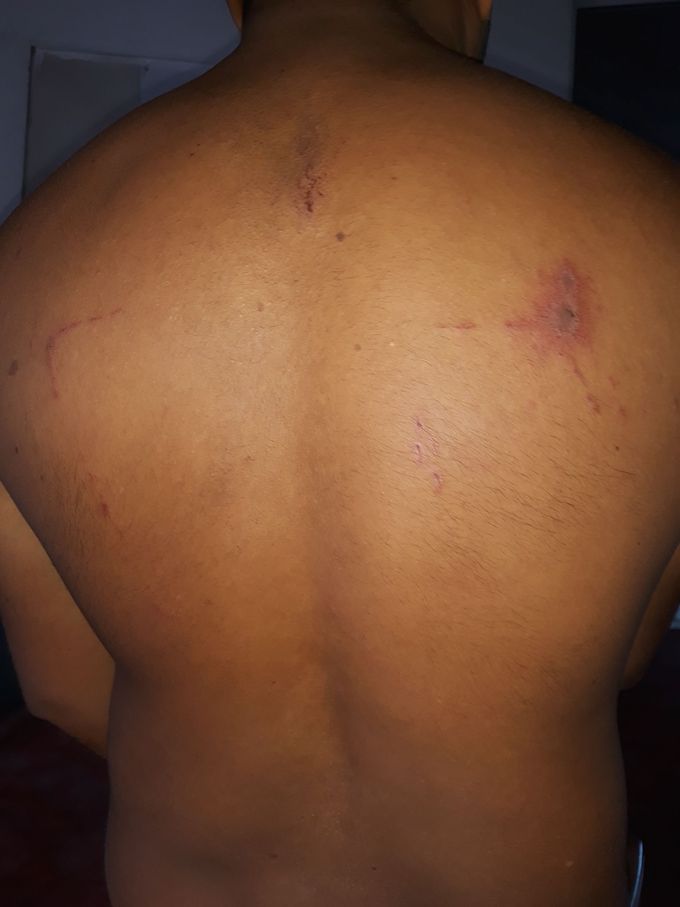 Which disease ?