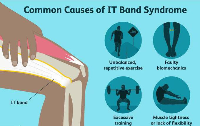 These are the common causes of IT band syndrome