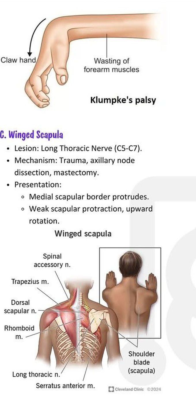 Brachial Plexus III