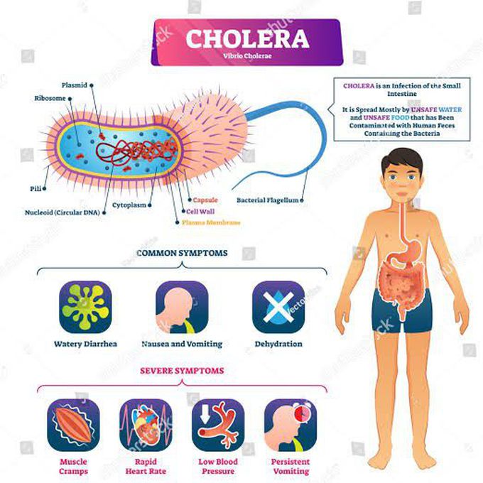 Cholera