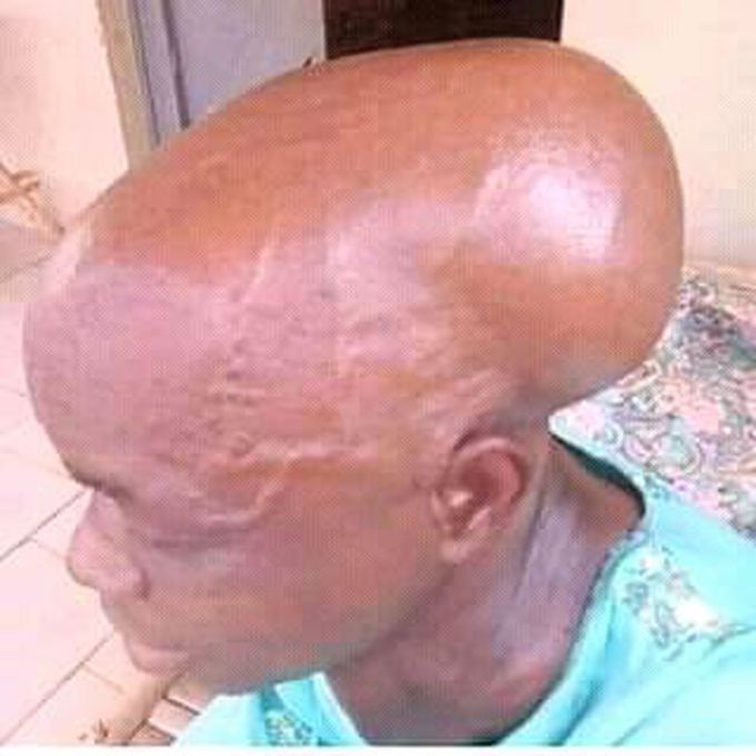 What cause this in human??