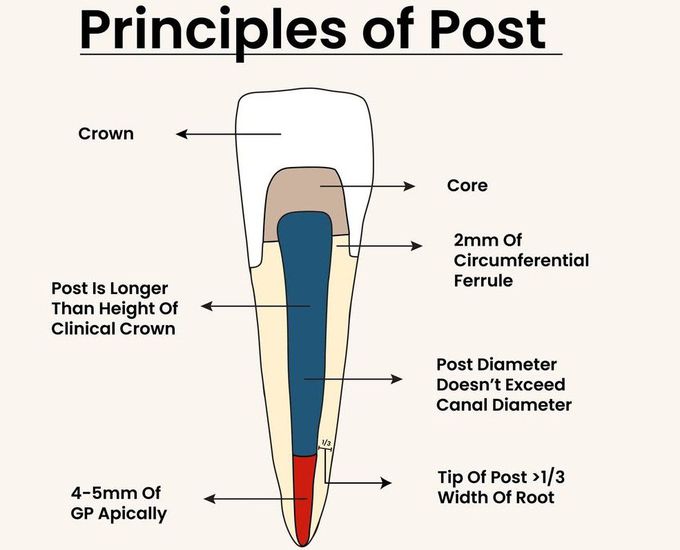 Principles of Post