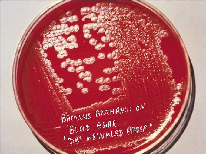 Bacillus Anthrax on Blood Agar