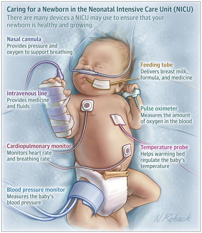 NICU. Care