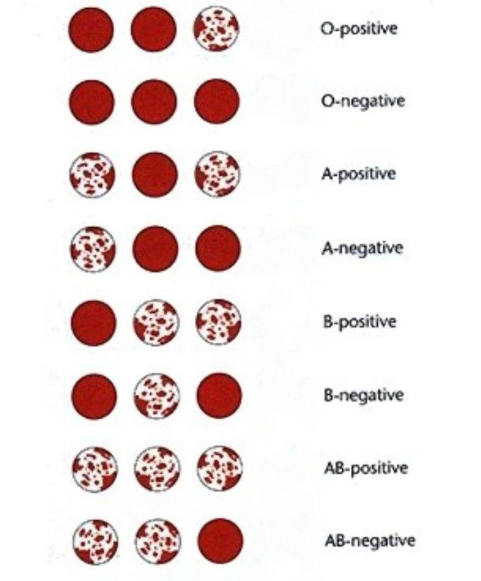 Pathology blood group determine analysis