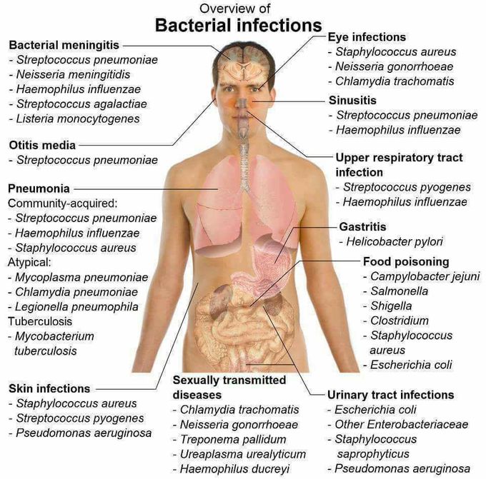 BACTERIAL INFECTIONS