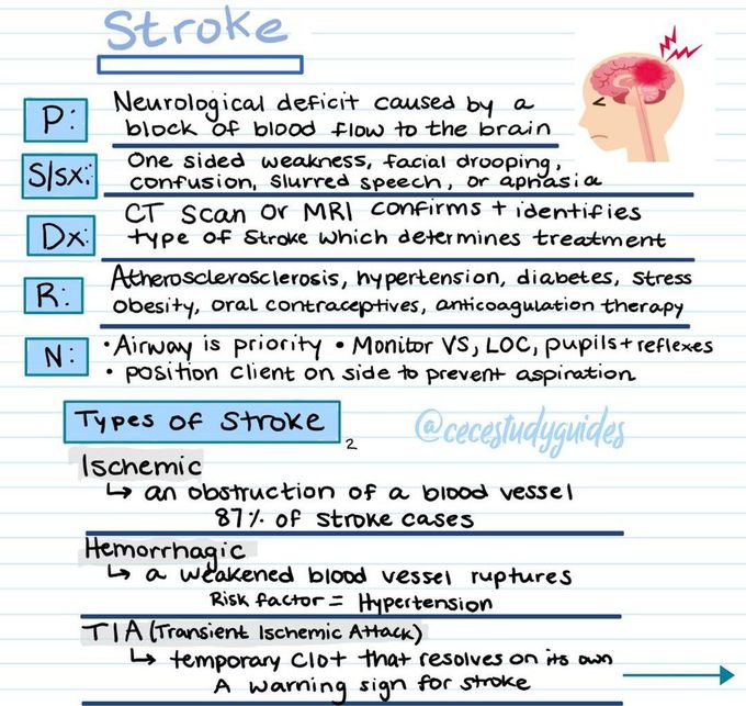 Stroke