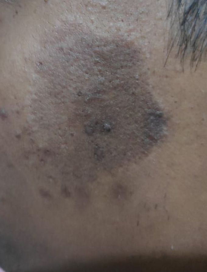 What could be diagnosis and treatment