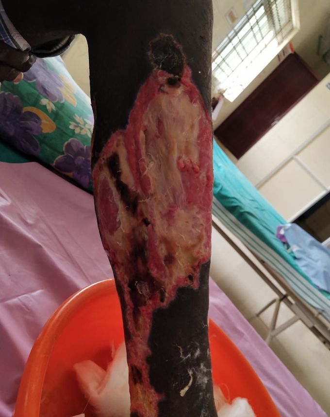 What is the probable diagnosis?