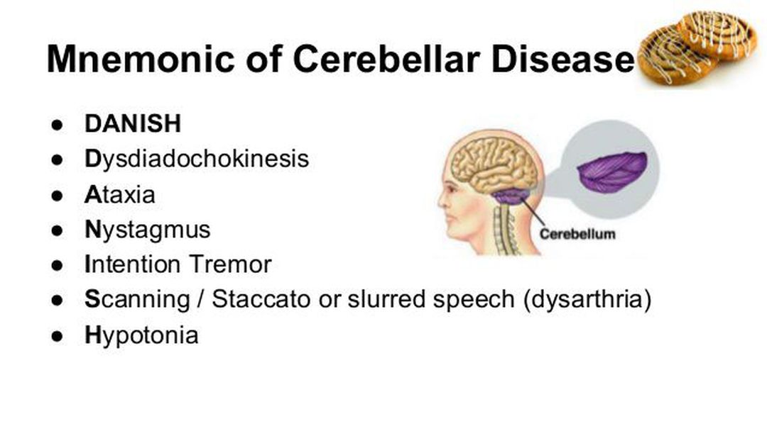 Signs and Symptoms of Cerebellar Lesion - MEDizzy