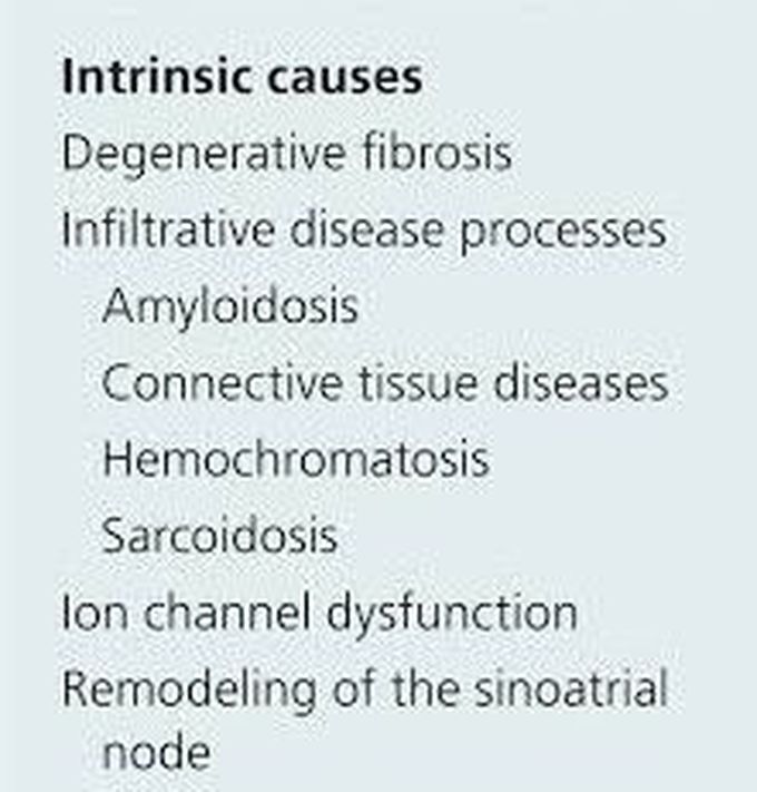 These are the causes of Sick sinus syndrome
