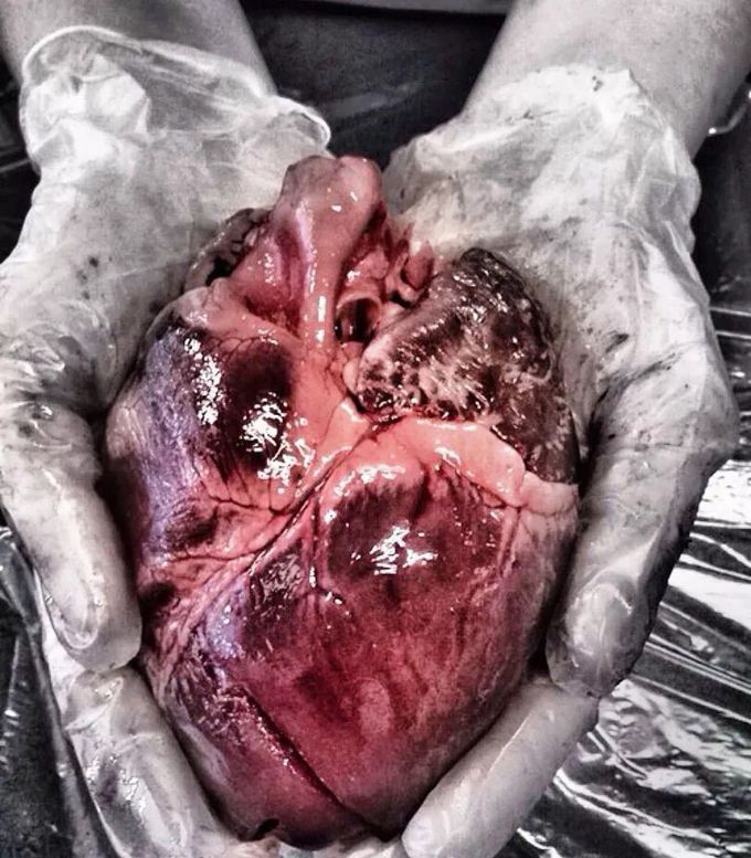 Heart