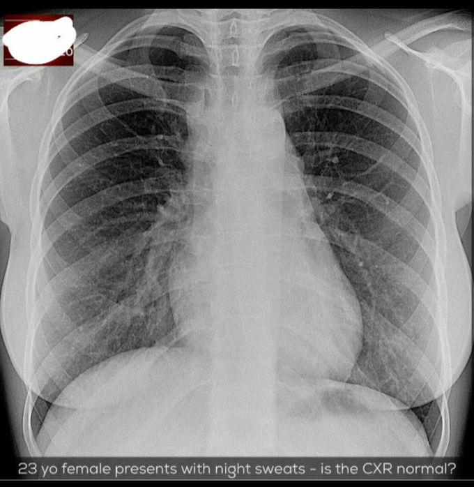 Diagnosis???