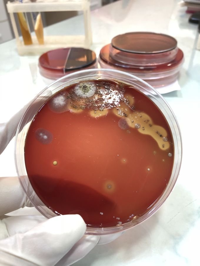 Aspergillus flavus on blood agar