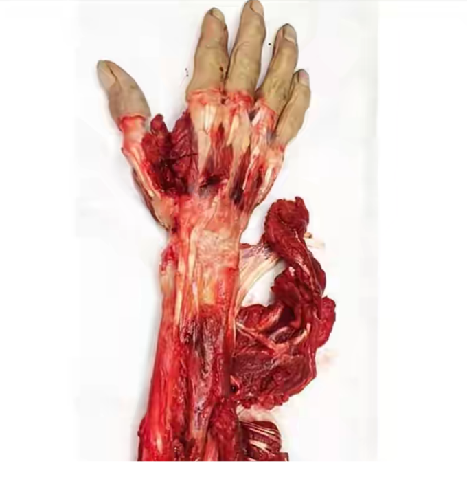 Muscles of the Forearm