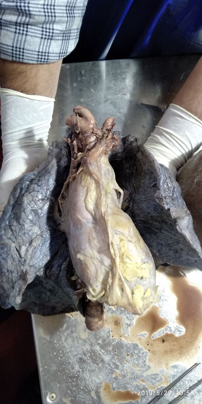 Heart with respiratory  system