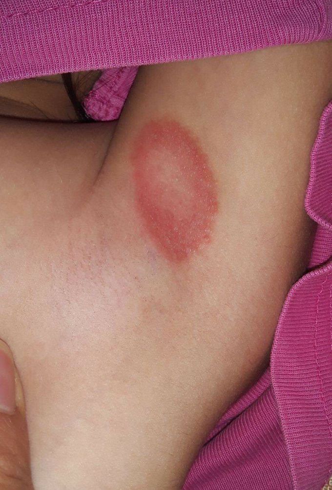 Diagnosis  ?